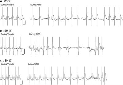 Irritant Inhalation Evokes P Wave Morphological Changes in Spontaneously Hypertensive Rats via Reflex Modulation of the Autonomic Nervous System